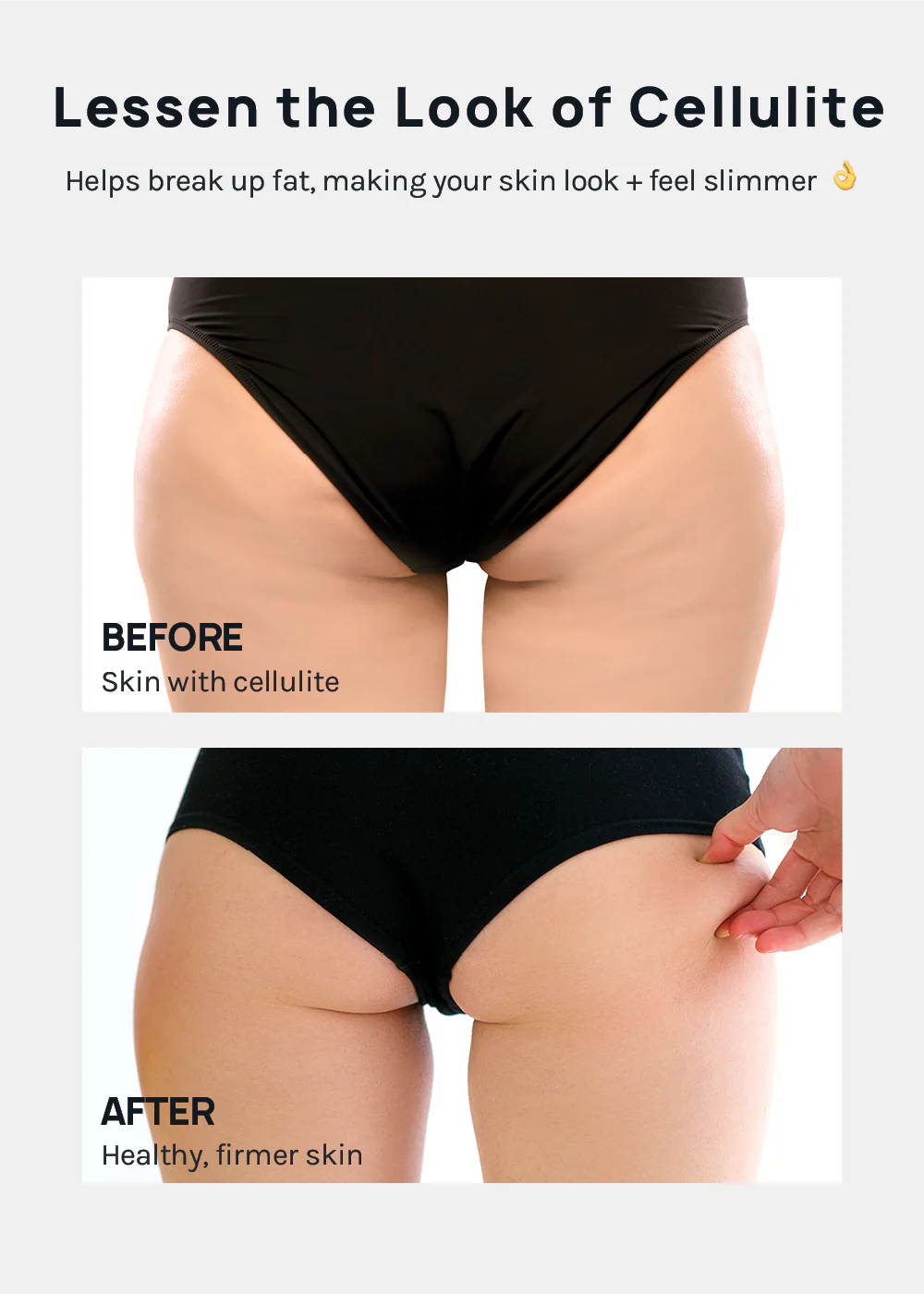 A+ Cellulite Massage Roller - Image 3