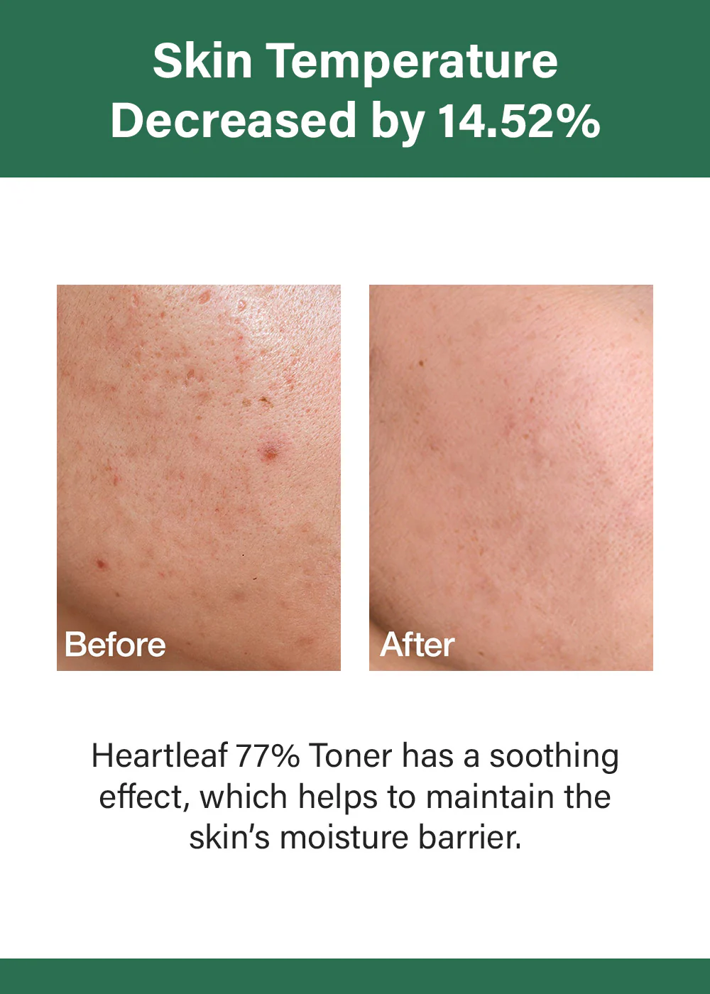 Anua Heartleaf 77 Soothing Toner 250ml - Image 3