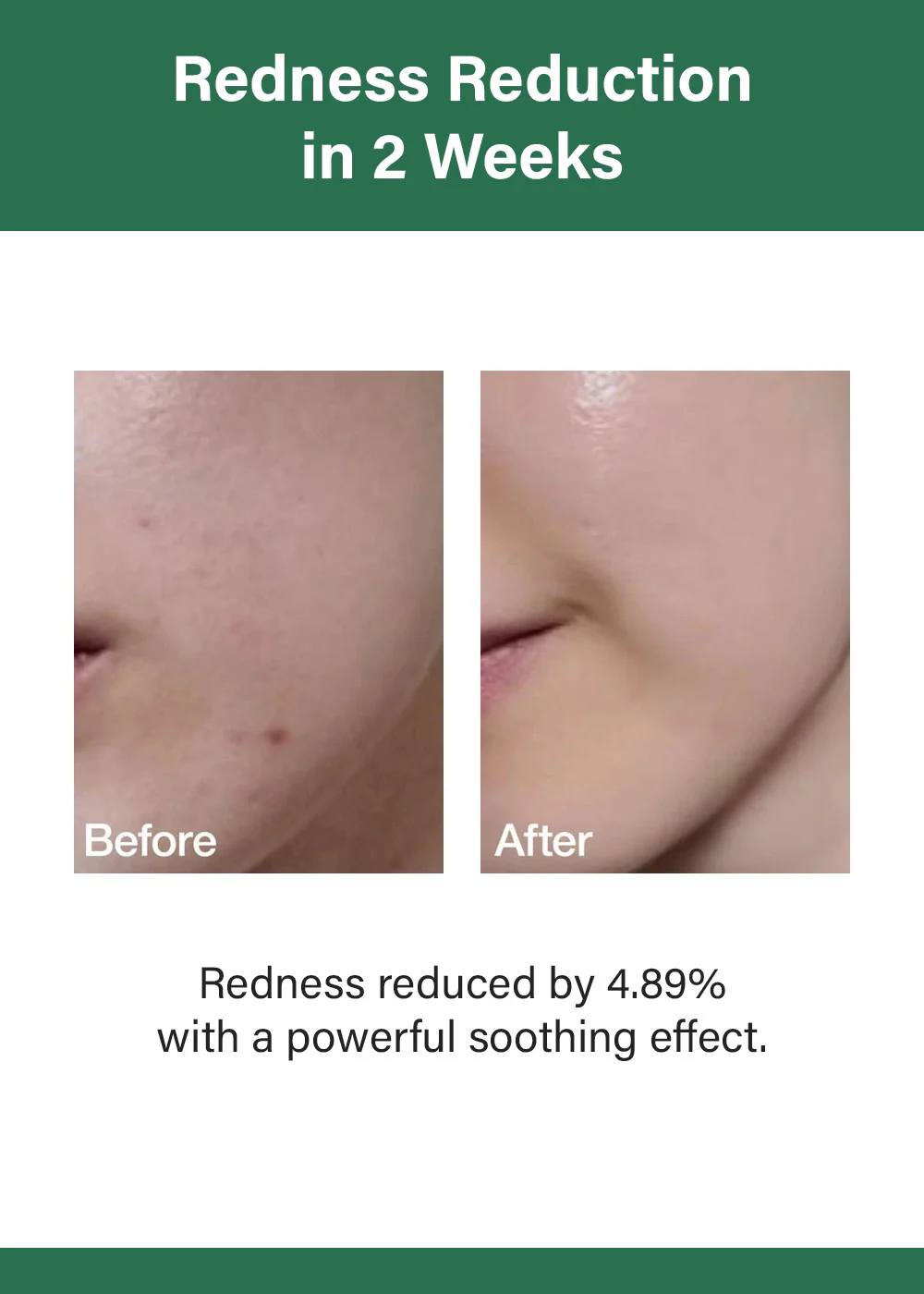 Anua Heartleaf 80 Moisture Soothing Ampoule 30ml - Image 3