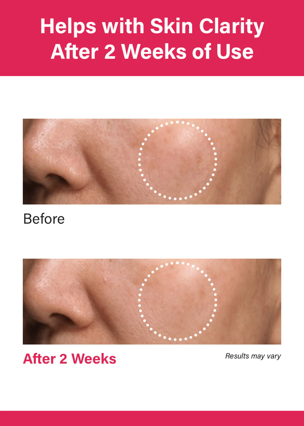 Anua Niacinamide 10% + TXA 4% Serum 30ml - Image 3