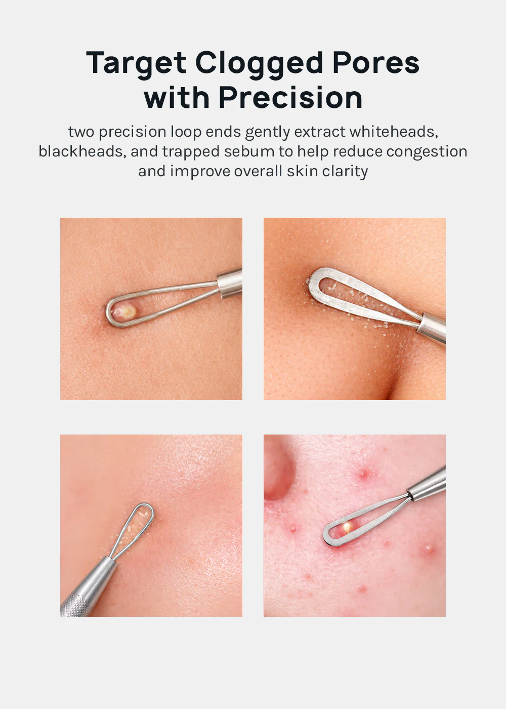 AOA Studio Blackhead Remover Tool - Image 3