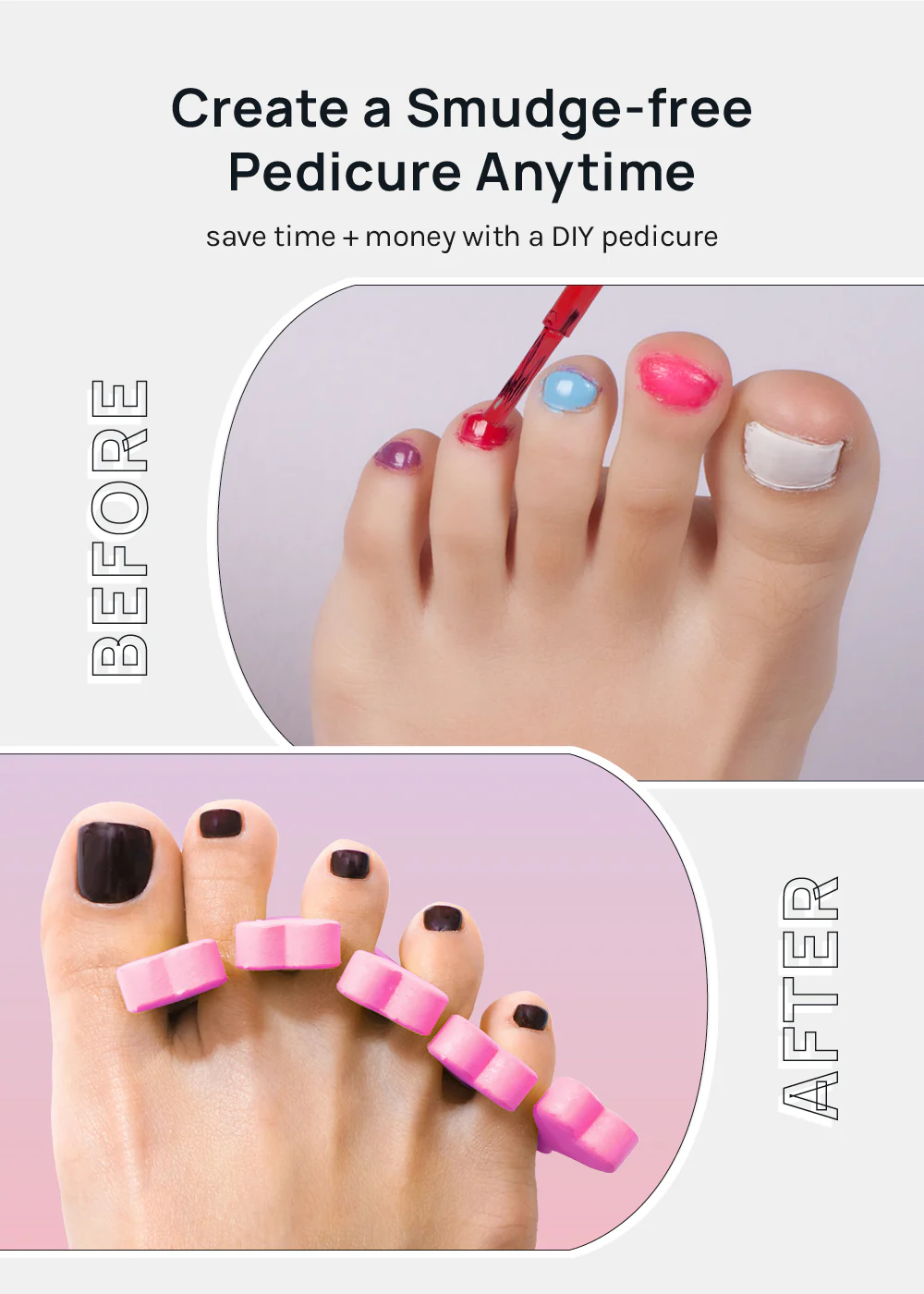 AOA Toe Spacers - Hearts - Image 2