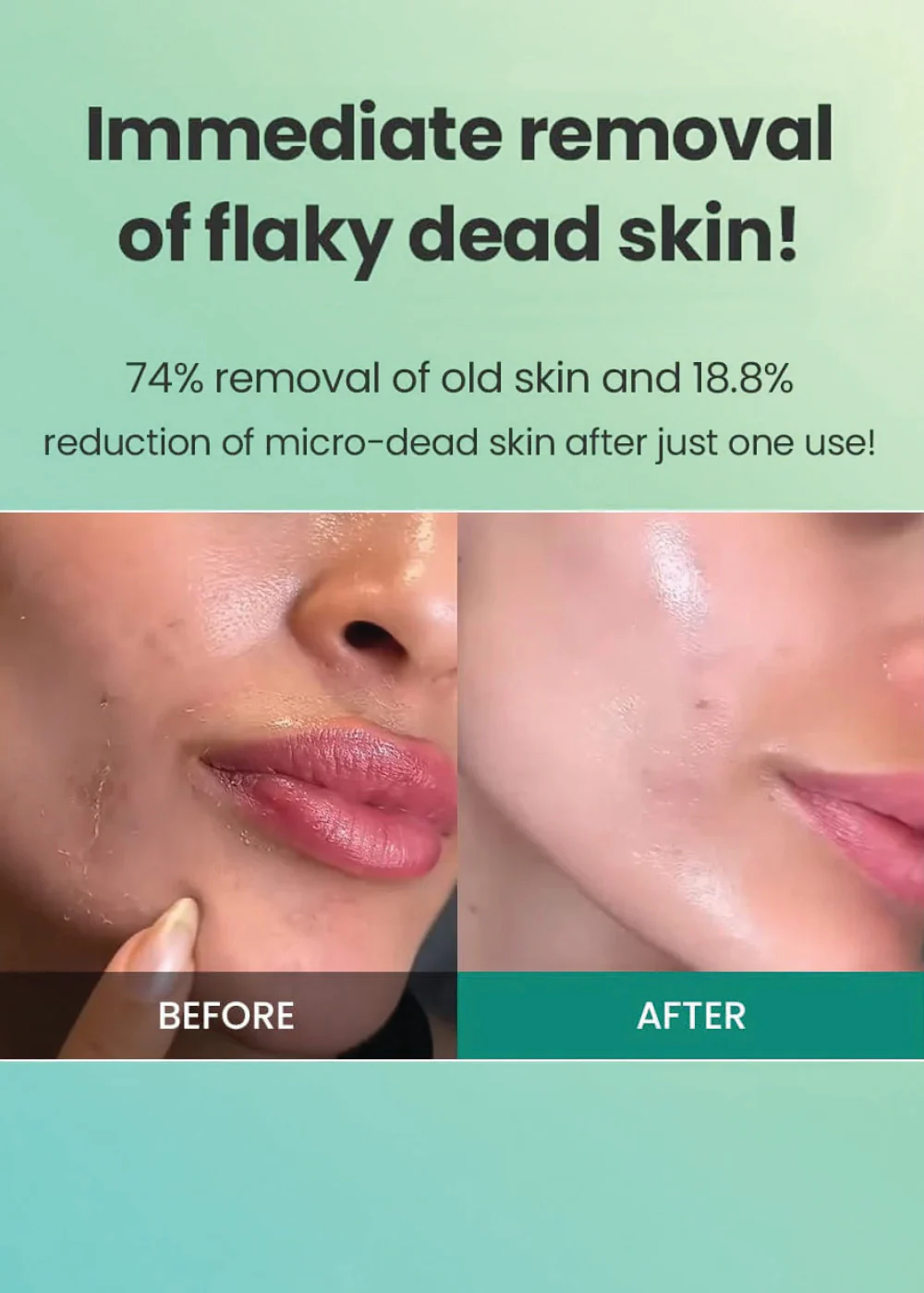 Dr.G Brightening Peeling Gel 120g - Image 5