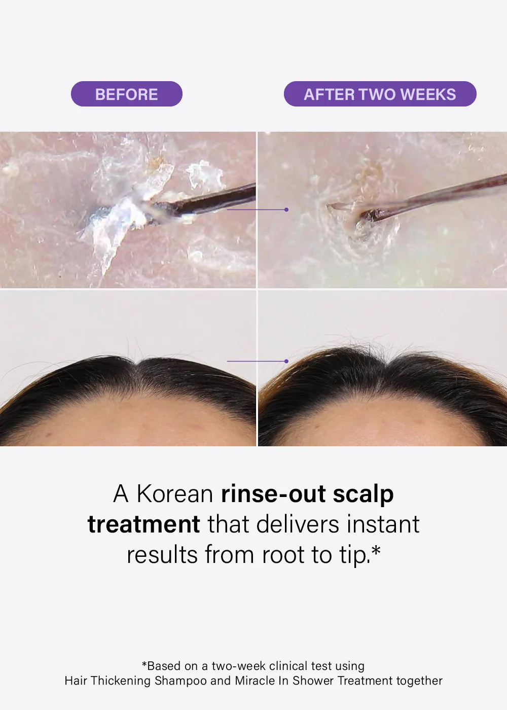 Dr. Groot Scalp Revitalizing Solution Miracle in Shower Treatment 250ml - Image 2