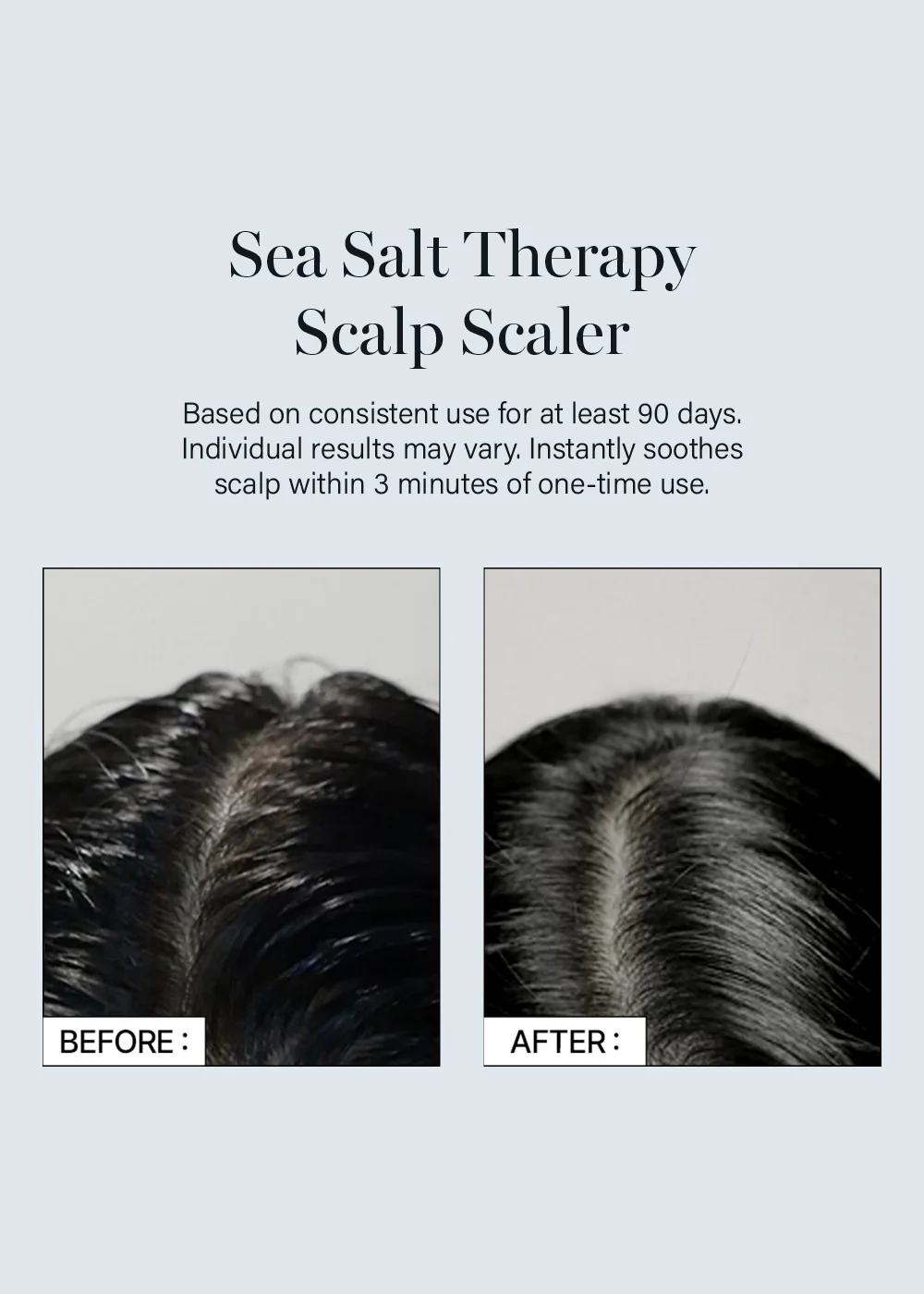 GROWUS Sea Salt Therapy Scalp Scaler 250g - Image 5