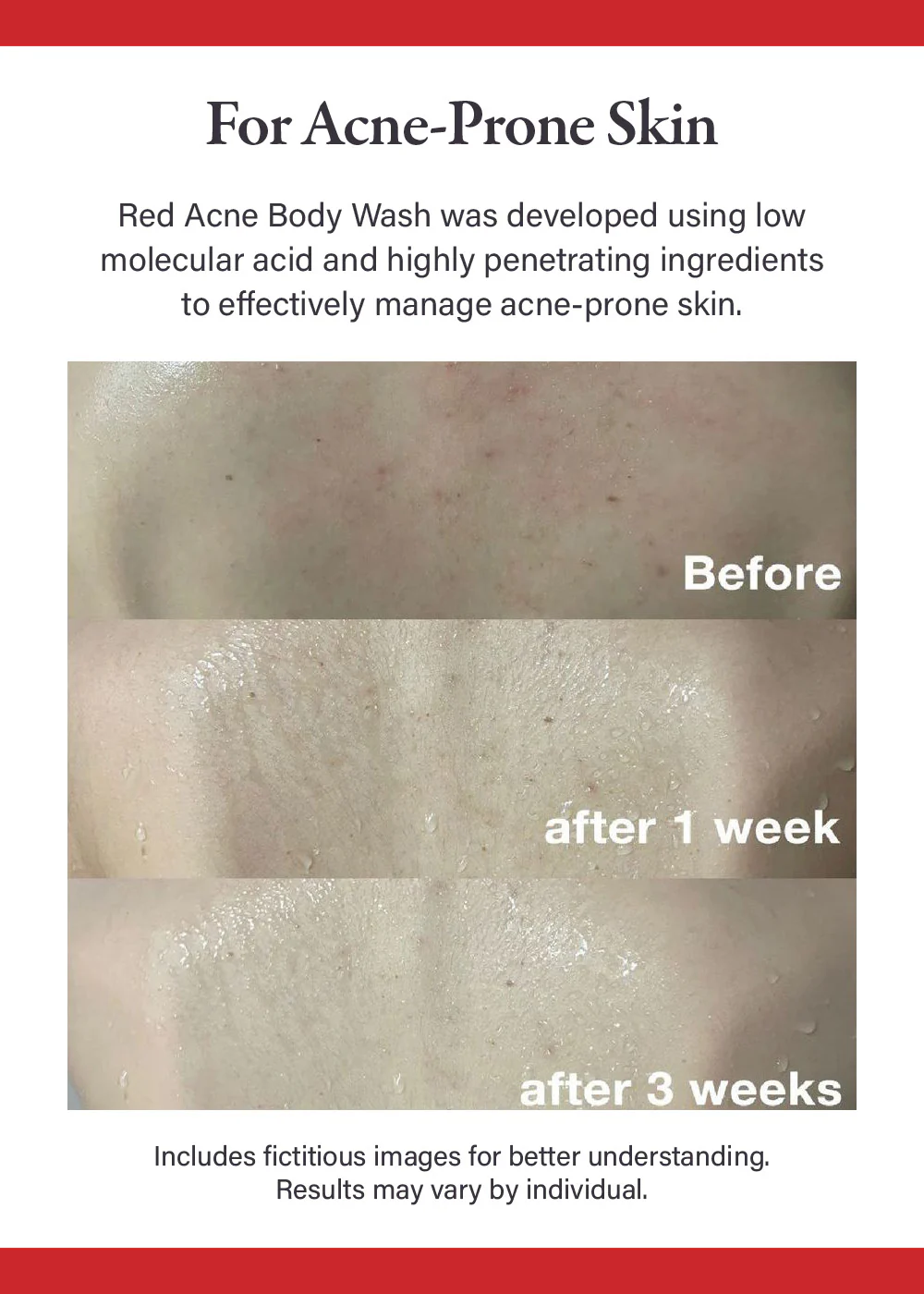 medicube Red Body Wash 400g - Image 2
