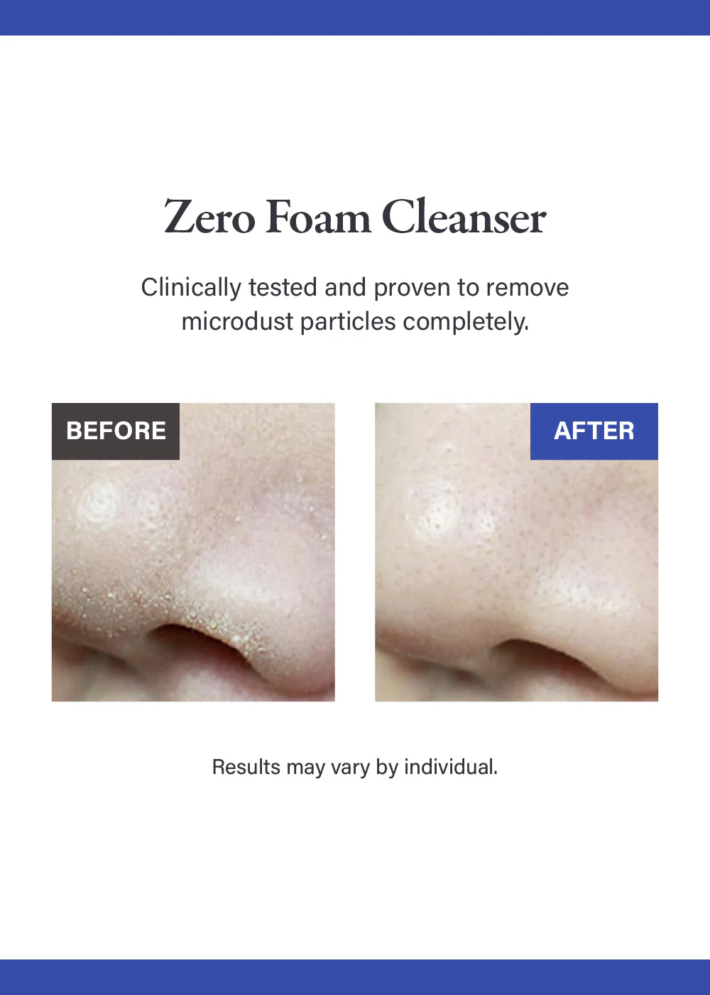 medicube Zero Foam Cleanser 120g - Image 2