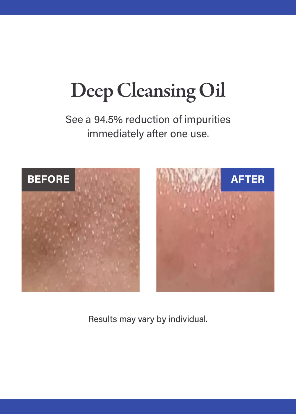 medicube Zero Pore Blackhead Deep Cleansing Oil 205ml - Image 2