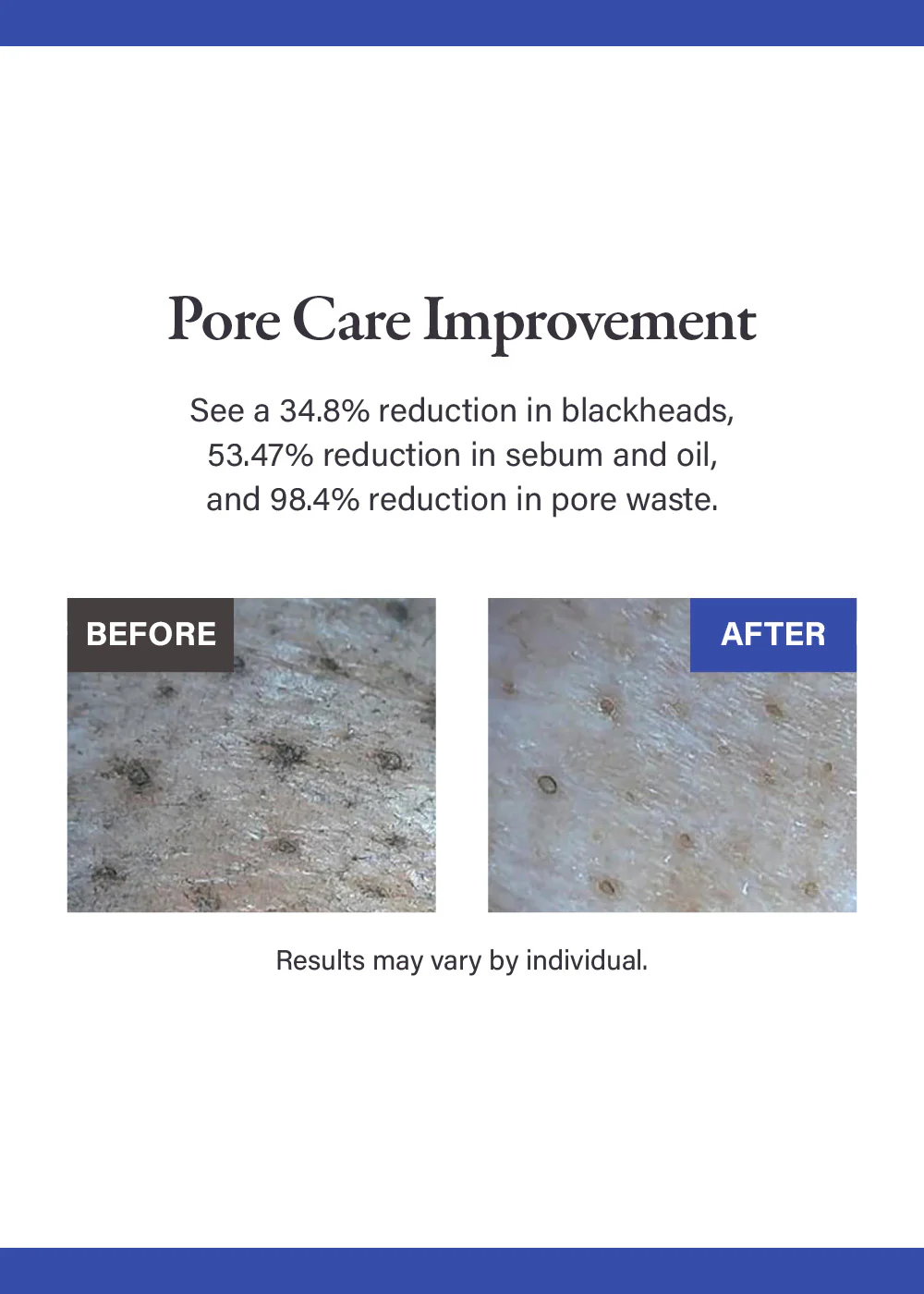medicube Zero Pore Blackhead Mud Mask 100g - Image 2