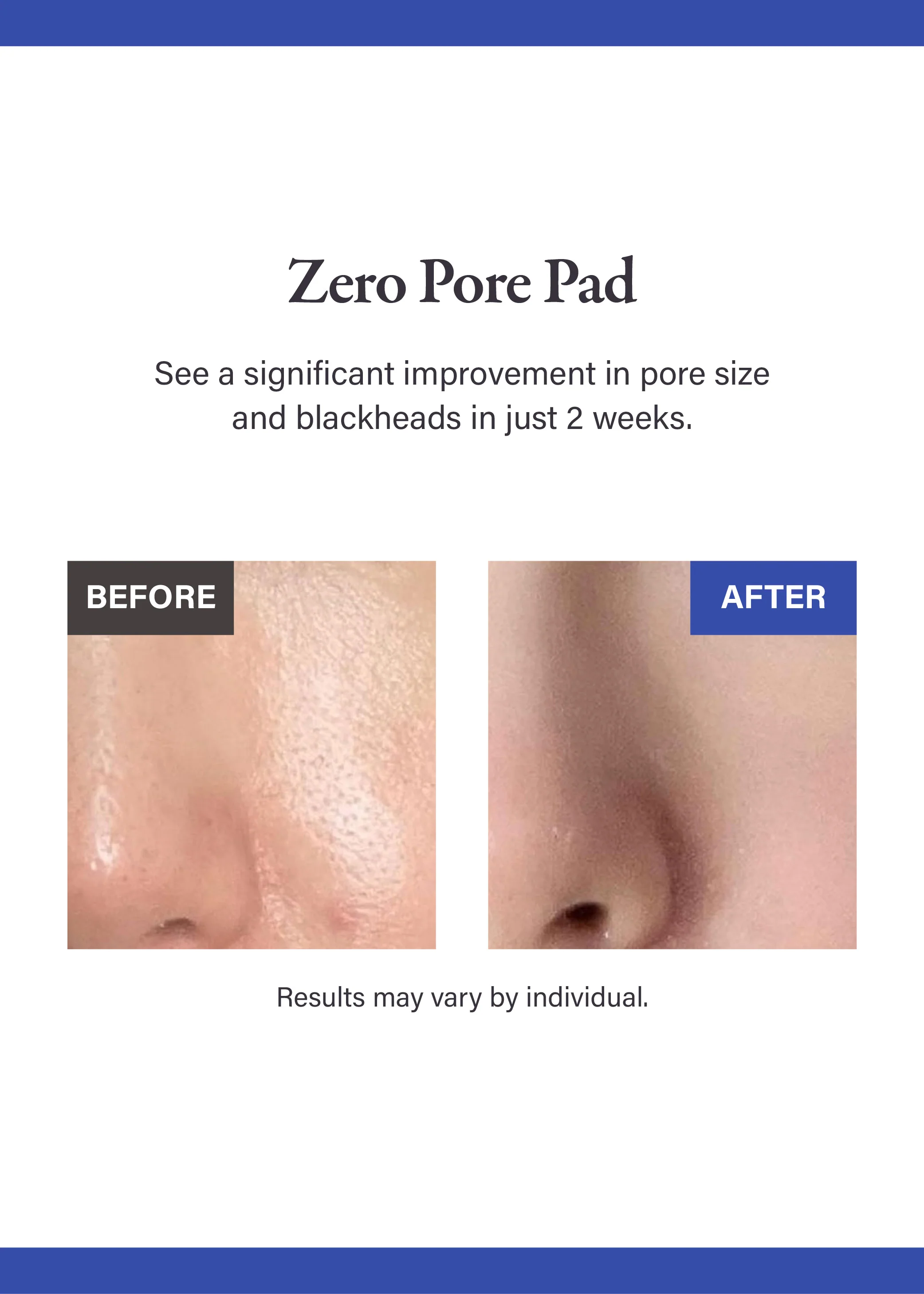 medicube Zero Pore Pad 2.0 (70 Pads) - Image 2