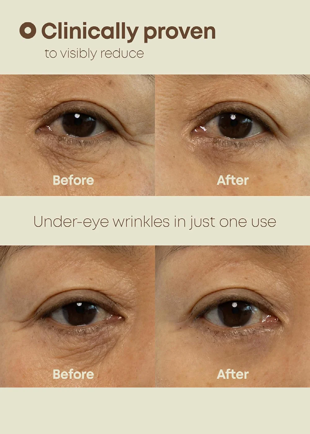 NINELESS Ever-Youth Dual Effect Eye Cream 20ml - Image 5