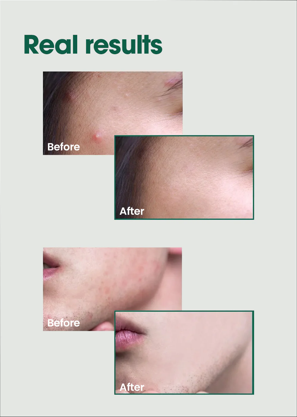 SOME BY MI AHA.BHA.PHA 30 Days Miracle Serum 50ml - Image 6