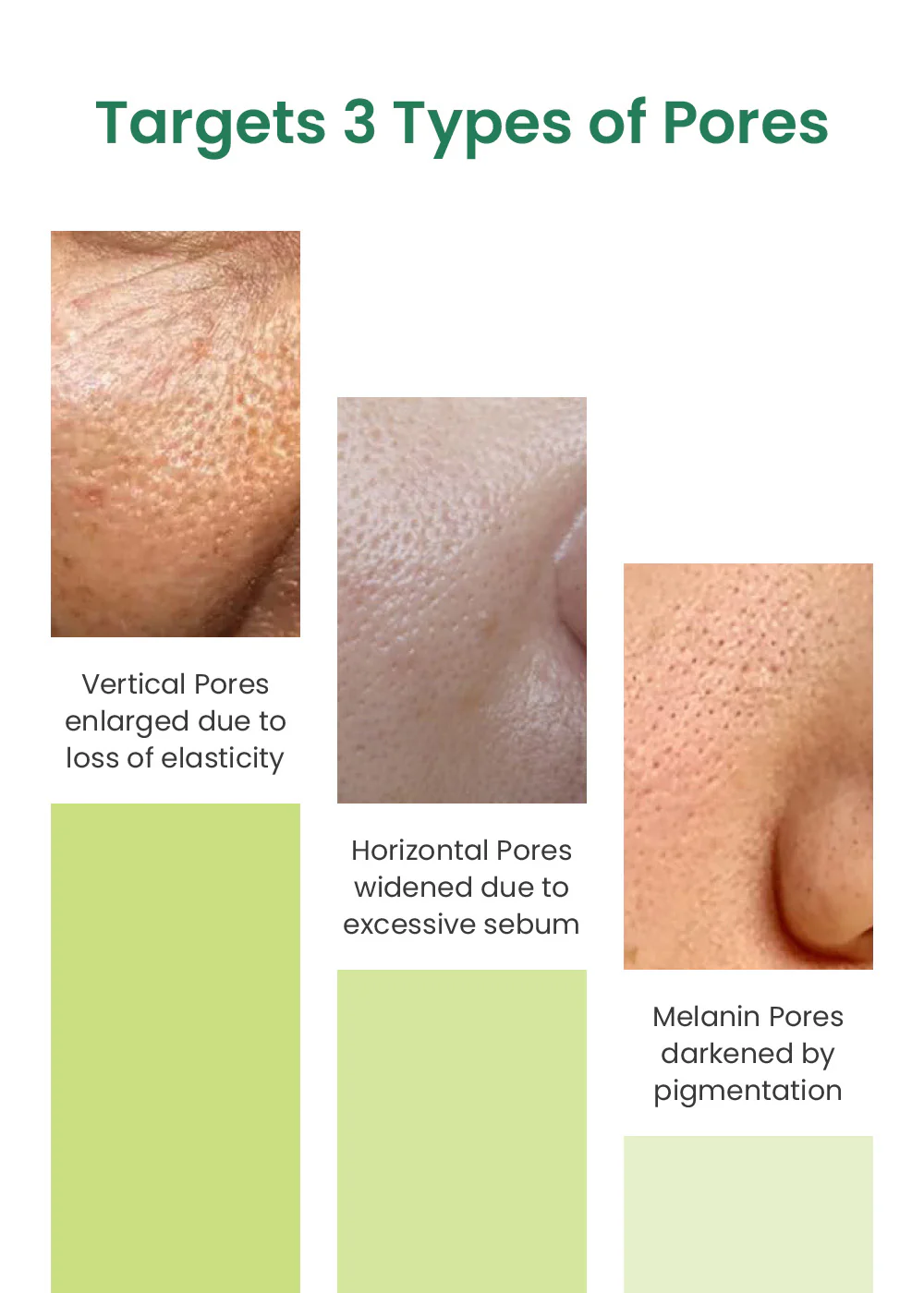 Sungboon Editor Green Tomato Pore Lifting Ampoule Toner 350ml - Image 3